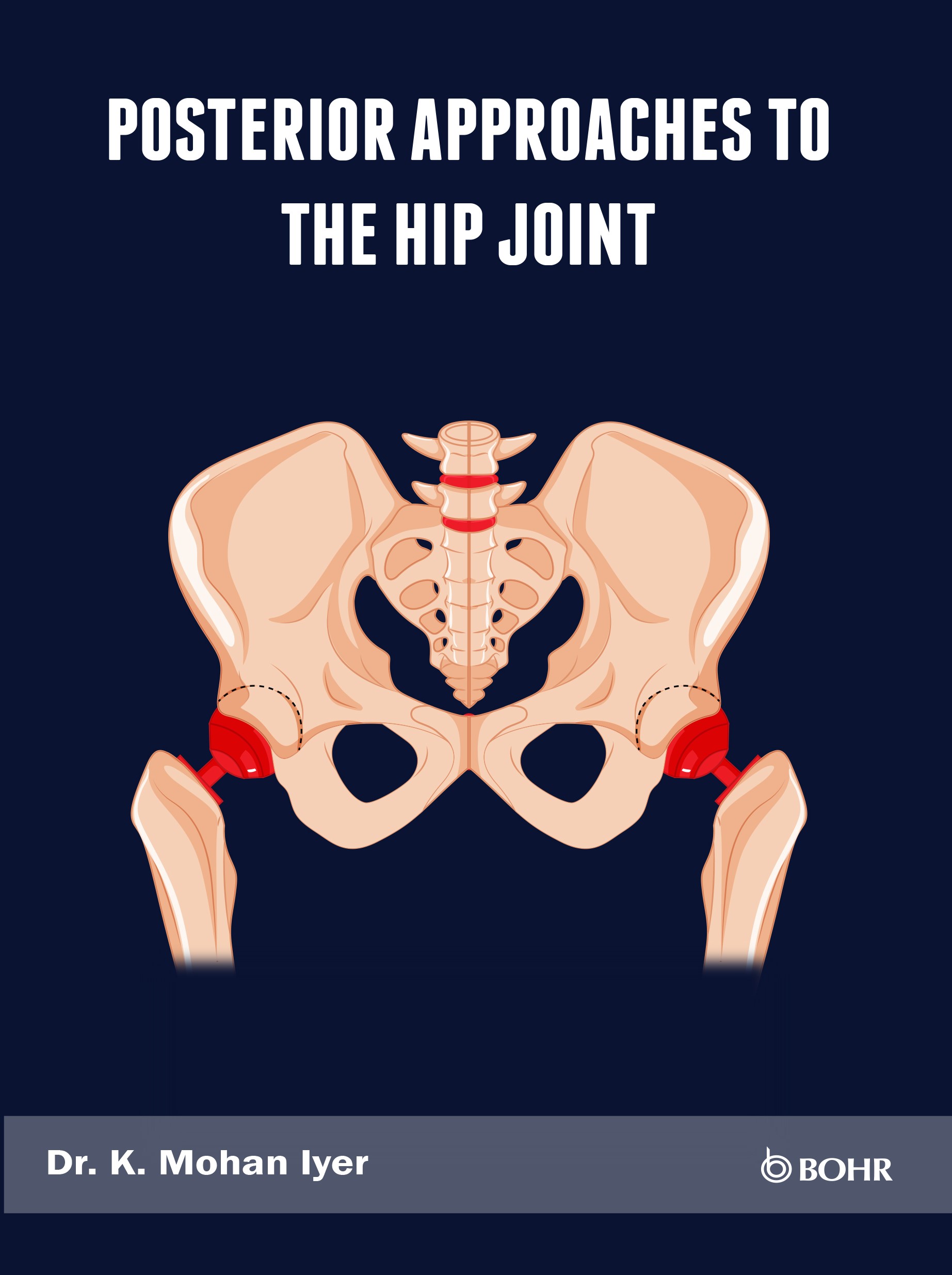 Posterior Approaches to the Hip Joint